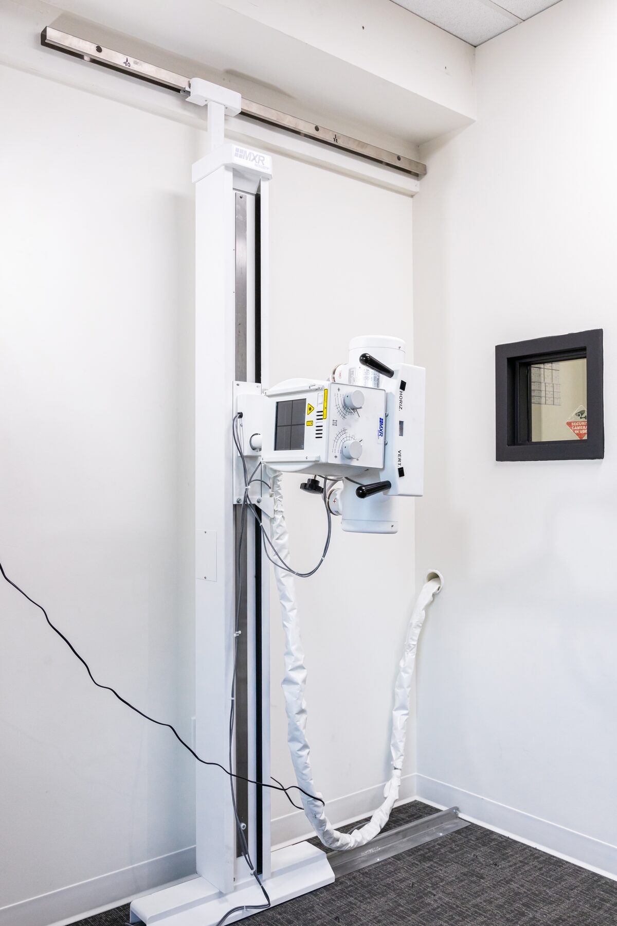 X ray or MRI after an accident?